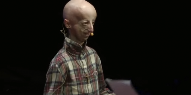 Nueva-terapia-contra-la-enfermedad-que-convierte-ninos-en-ancianos_image_380