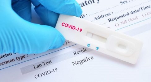 coronavirus-test-728